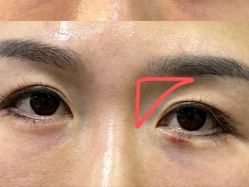 体验后-武汉颜范薇美医疗美容门诊部