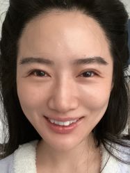 点击看大图 体验前-深圳美莱医疗美容医院