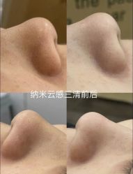 -SKIN79皮肤管理中心