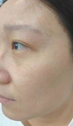 -北京美痣堂古方祛痣斑疣瘊