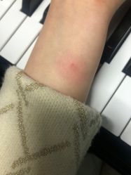 -More摩尔医美の注射线雕光电中心