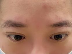 体验后-烟台曙光医疗美容医院
