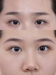 -张小野·专业半永久纹眉