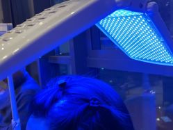 -碧莲盛·不剃发植发