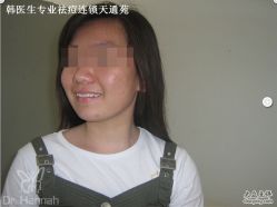 -韩医生专业祛痘连锁机构