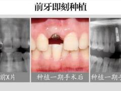 -团圆口腔·种植中心(锦江院区)