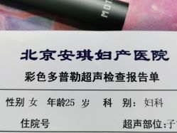 -北京安琪