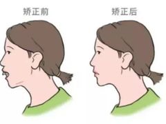-柏乐口腔(南宁总院)