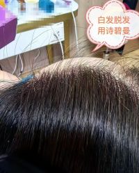 -诗碧曼养发