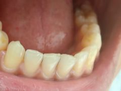 -极光口腔·矫正种植修复(锦江院区)