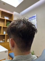 -大麦微针植发全国连锁