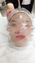 -美壹生诊所皮肤管理中心·海菲秀&Legacy美白舱
