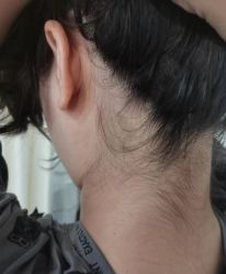 -薇兰专业脱毛连锁机构