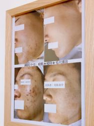 -美肤盾祛痘·问题肌头疗管理中心