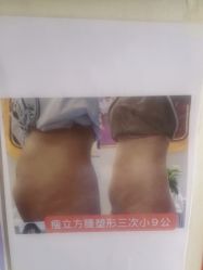 -瘦立方身材管理中心