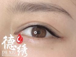 -德绣·机器野生眉发际线·美瞳线半永久