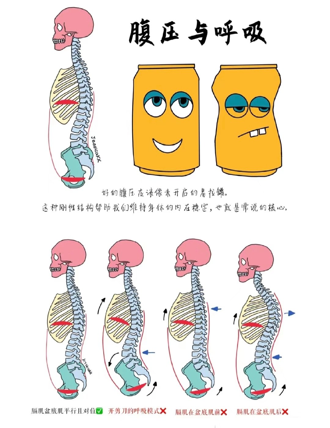 简易腹内压测量图片图片