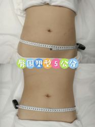 -Lily纤美·科技减脂中心