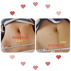 -贝美佳产后修复中心