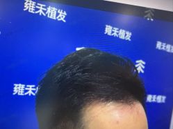 -雍禾植发全国连锁