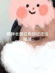 体验后-南京医科大学友谊整形外科医院