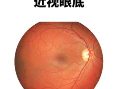 -诺柯视眼镜-蔡司依视路官方工厂店(淞南一店)