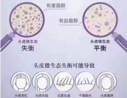 -侗秀养发•头疗