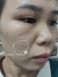 -深圳春天阳光医院·轮廓抗衰中心