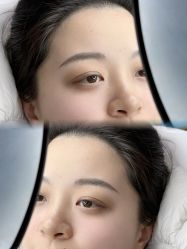-张小野·专业半永久纹眉