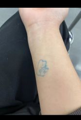 -天道专业洗纹身