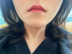 -大华韩艺整形美容医院