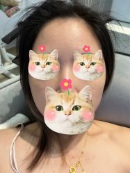 体验后-深圳美莱医疗美容医院