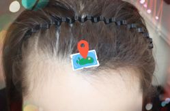 -大麦微针植发全国连锁