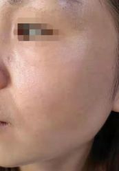 -北京美痣堂古方祛痣斑疣瘊