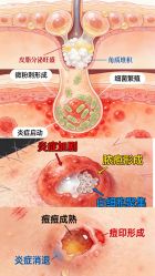 -克丽缇娜