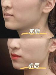 -重庆军科整形美容医院