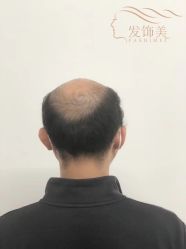 -发饰美男士增发补发假发定制店