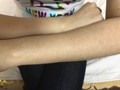 -荟草堂痘肌修护中心