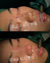 -北京米扬丽格医疗美容·联合丽格鼻整形中心