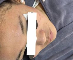 -杭州米兰柏羽医疗美容医院