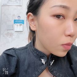 点击看大图 体验后-圣嘉新医疗美容医院