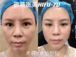 -YESIDO椰岛美容