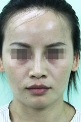 -圣嘉新医疗美容医院