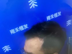 -雍禾植发全国连锁