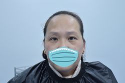 -广州健丽·去眼袋医疗美容机构