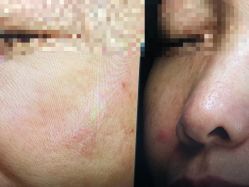 -丽美妍医疗美容·皮秒·立体分层抗衰