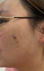 体验前-美莱医学美容医院