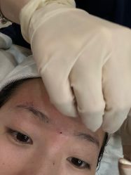 -郡艺医疗美容·微整·眼鼻吸脂