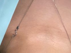 体验前-联合丽格·张菡丽格医疗美容