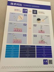 体验前-大麦微针植发全国连锁